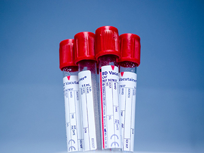 Blood Test Tubes