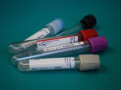 Medical Test Tubes