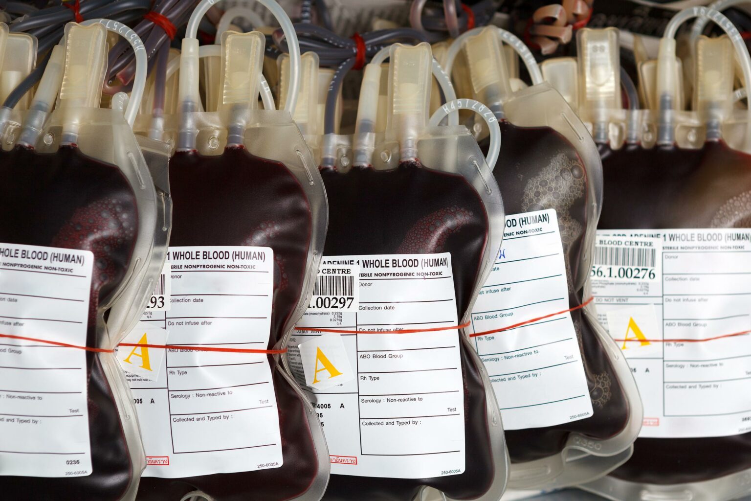 blood iv bag labeling
