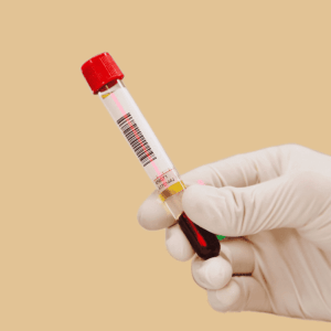 Laboratory labelling